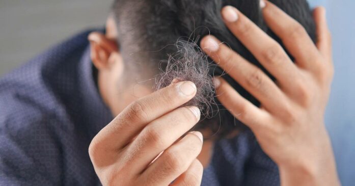 hair loss treatment in solihull
