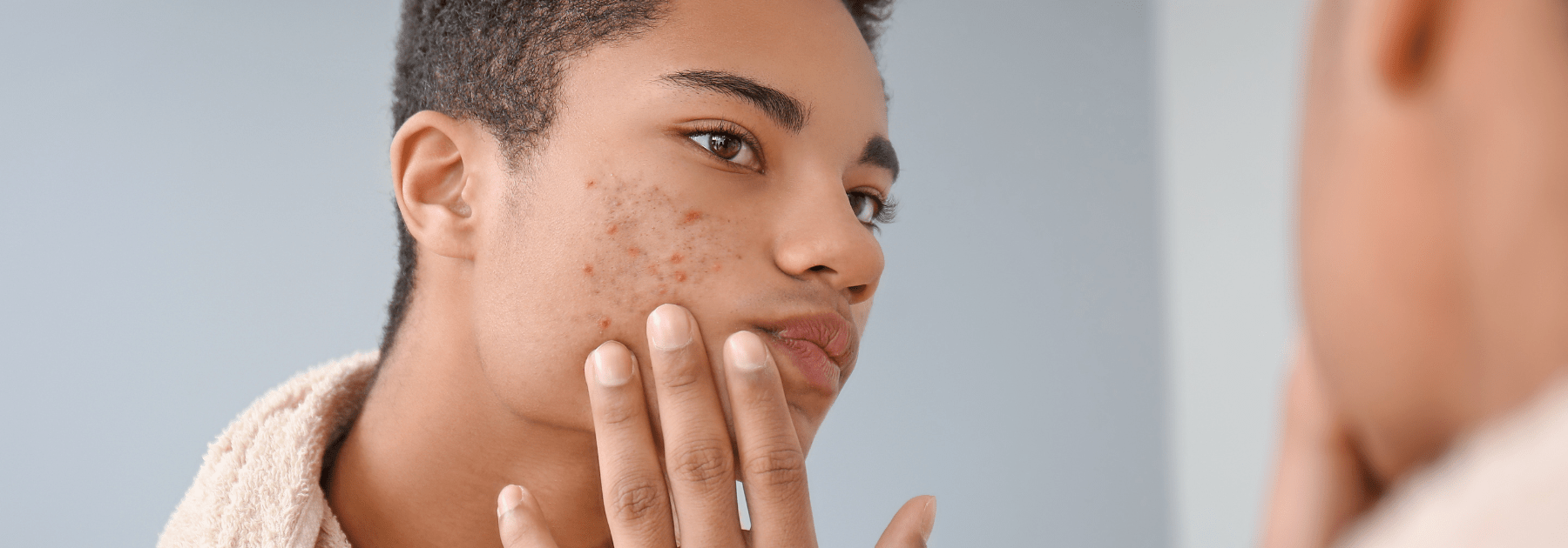 acne treatment birmingham