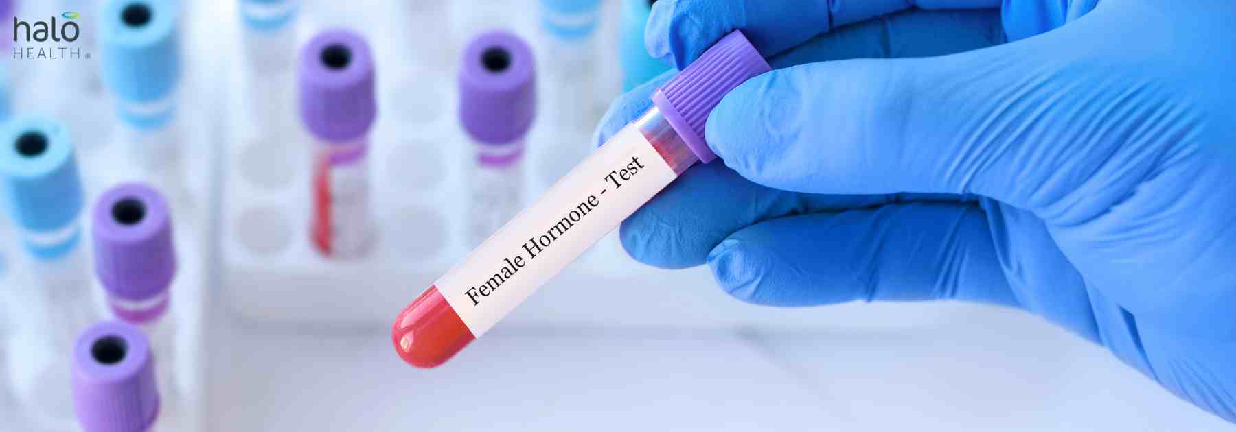 female hormone blood test