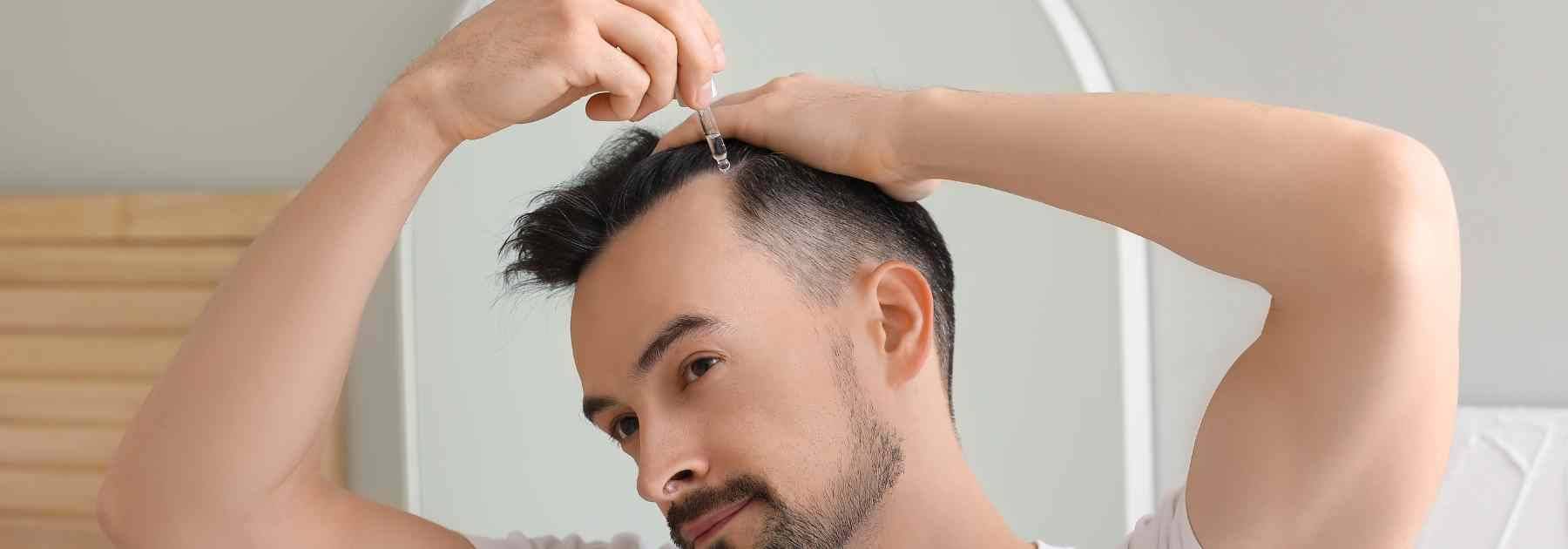 Find out about combining Finasteride and Minoxidil